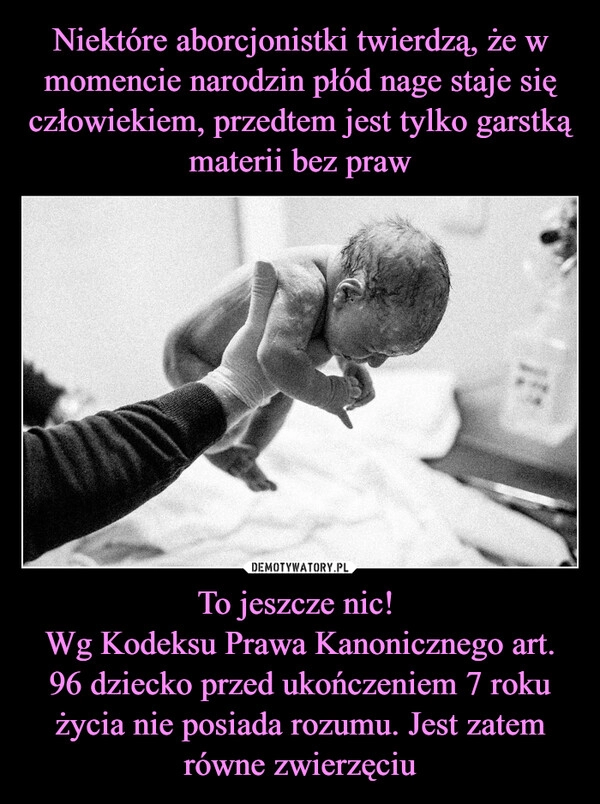 
    
Niektóre aborcjonistki twierdzą, że w momencie narodzin płód nage staje się człowiekiem, przedtem jest tylko garstką materii bez praw To jeszcze nic!
Wg Kodeksu Prawa Kanonicznego art. 96 dziecko przed ukończeniem 7 roku życia nie posiada rozumu. Jest zatem równe zwierzęciu 