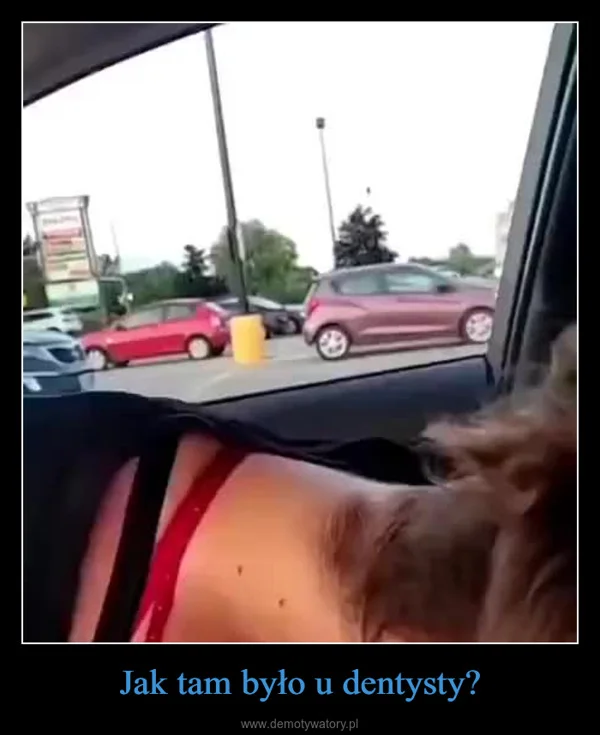 
    Jak tam było u dentysty?