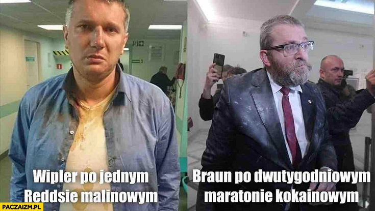 
    Wipler po jednym Reddsie malinowym vs Braun po dwutygodniowym maratonie kokainowym