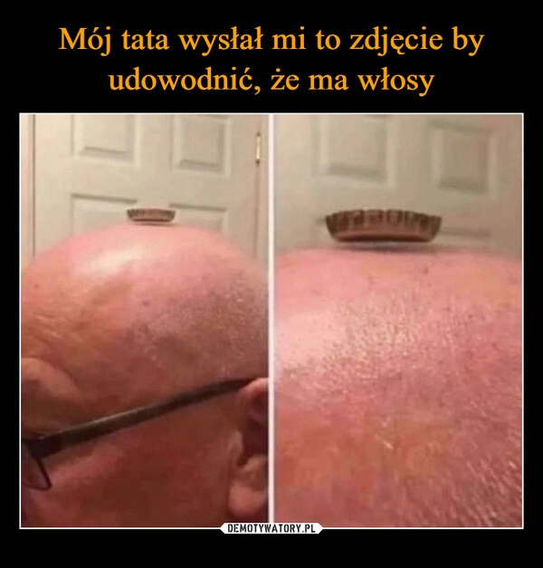 
    Mój tata wysłał mi to zdjęcie by udowodnić, że ma włosy