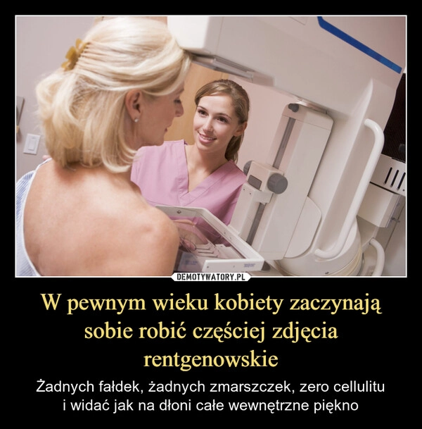
    W pewnym wieku kobiety zaczynają sobie robić częściej zdjęcia rentgenowskie