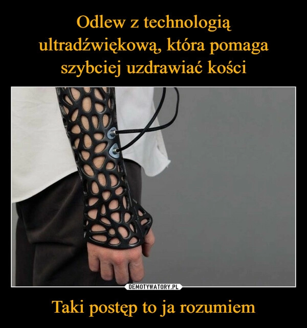 
    Odlew z technologią ultradźwiękową, która pomaga szybciej uzdrawiać kości Taki postęp to ja rozumiem