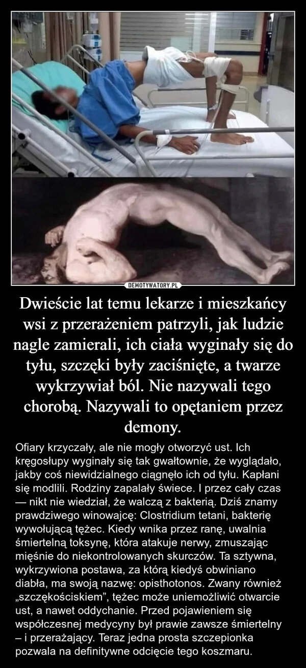 
    Dwieście lat temu lekarze i mieszkańcy wsi z przerażeniem patrzyli, jak ludzie nagle zamierali, ich ciała wyginały się do tyłu, szczęki były zaciśnięte, a twarze wykrzywiał ból. Nie nazywali tego chorobą. Nazywali to opętaniem przez demony.