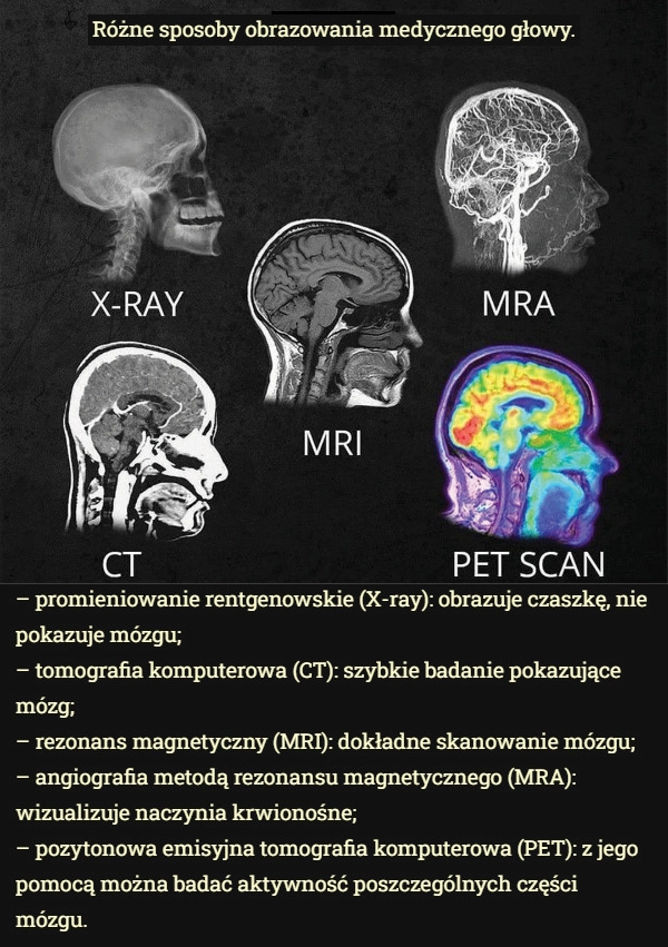 
    
			Różne sposoby obrazowania medycznego głowy.					