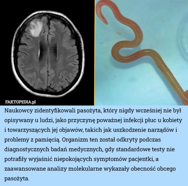 
    Naukowcy zidentyfikowali pasożyta, który nigdy wcześniej nie był opisywany