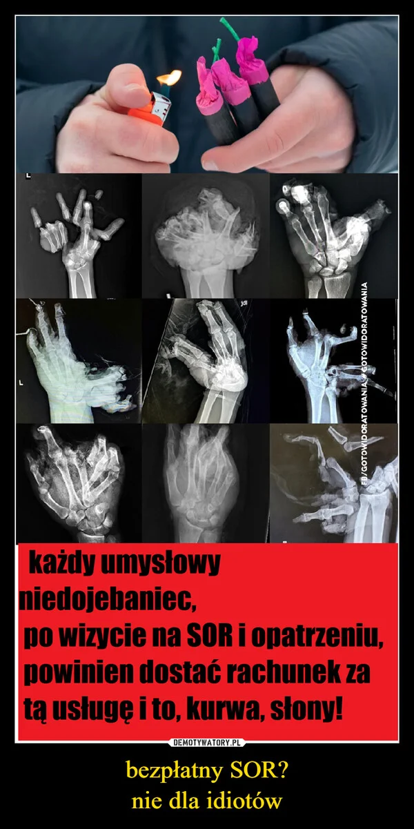 
    bezpłatny SOR? nie dla idiotów