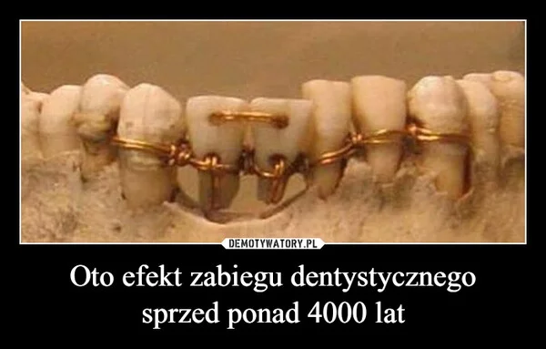 Oto efekt zabiegu dentystycznego sprzed ponad 4000 lat