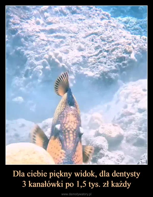 
    Dla ciebie piękny widok, dla dentysty 3 kanałówki po 1,5 tys. zł każdy