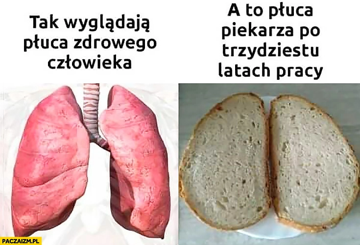 
    Tak wyglądają płuca zdrowego człowieka, a to płuca piekarza po trzydziestu latach pracy chleb