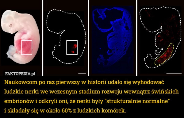 
    Naukowcom po raz pierwszy w historii udało się wyhodować ludzkie nerki we...