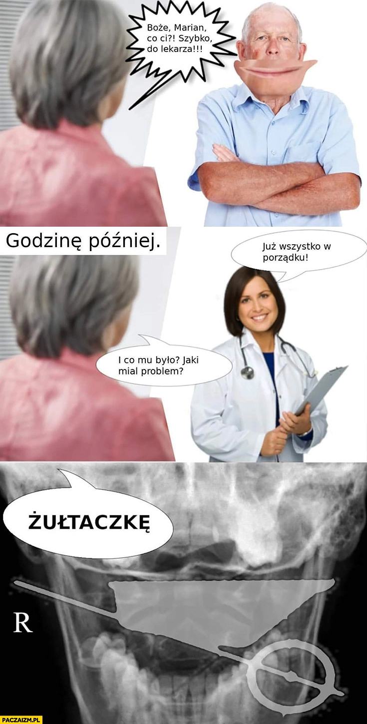 
    Marian co Ci się stało? Jaki miał problem? Żółtaczkę żuł taczkę prześwietlenie taczka w ustach