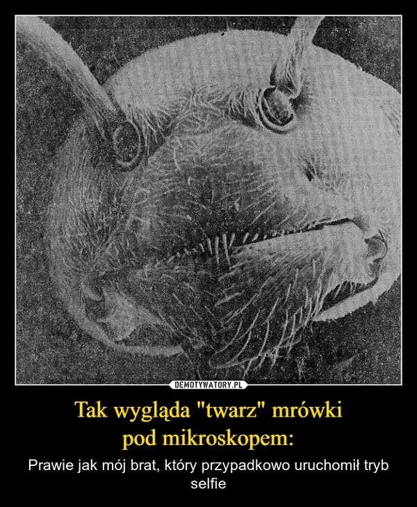 
    Tak wygląda "twarz" mrówki
pod mikroskopem: