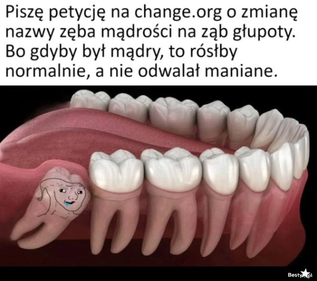 
    Ząb mądrości 