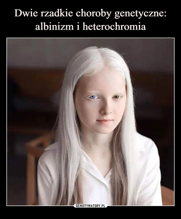 
    Dwie rzadkie choroby genetyczne: albinizm i heterochromia