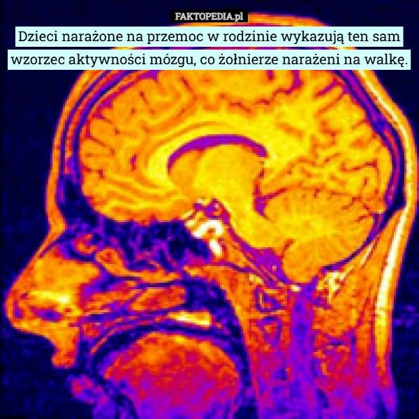 
    Dzieci narażone na przemoc w rodzinie wykazują ten sam wzorzec aktywności...