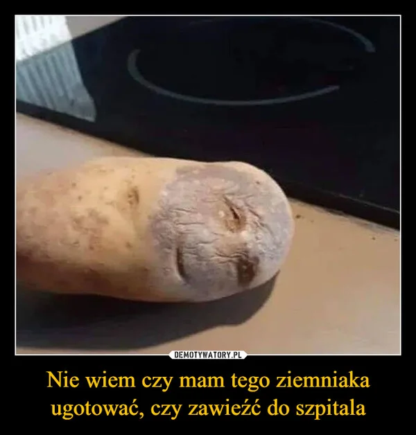 
    Nie wiem czy mam tego ziemniaka ugotować, czy zawieźć do szpitala