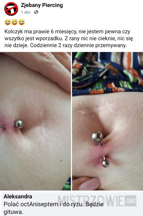 
    Kolczyk