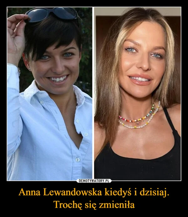 Anna Lewandowska kiedyś i dzisiaj. Trochę się zmieniła