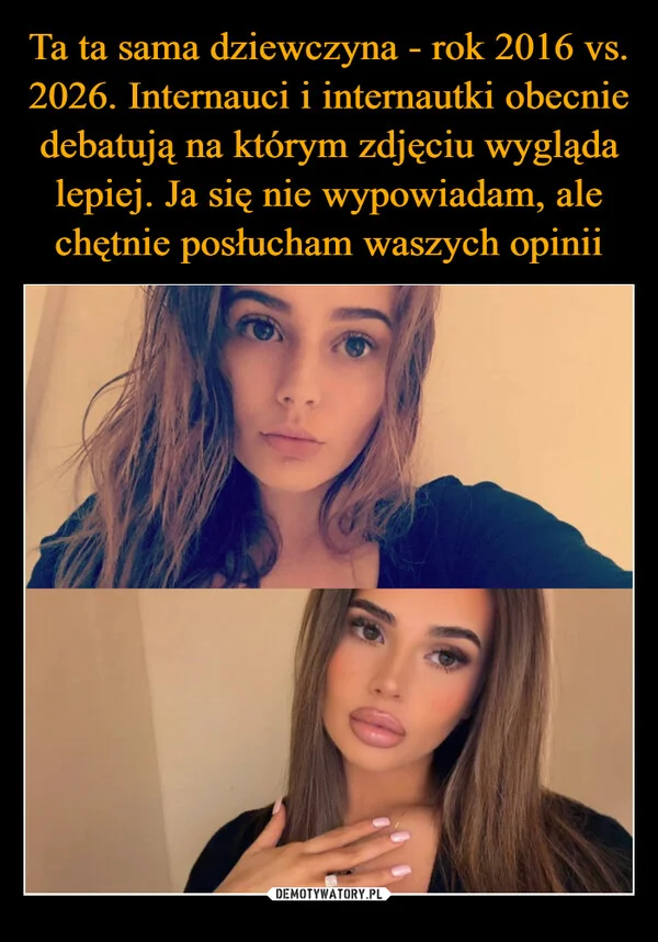 
    Ta ta sama dziewczyna - rok 2016 vs. 2026. Internauci i internautki obecnie debatują na którym zdjęciu wygląda lepiej. Ja się nie wypowiadam, ale chętnie posłucham waszych opinii