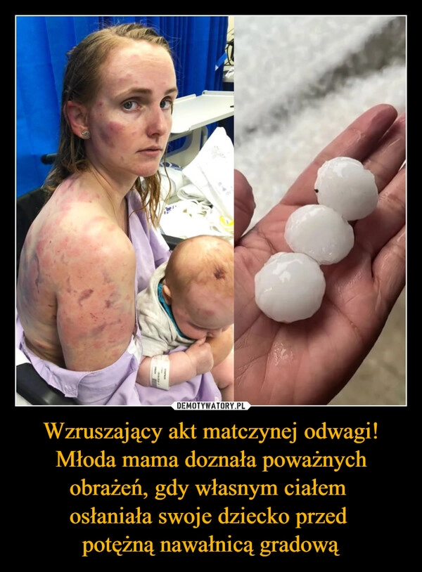 
    Wzruszający akt matczynej odwagi! Młoda mama doznała poważnych obrażeń, gdy własnym ciałem 
osłaniała swoje dziecko przed 
potężną nawałnicą gradową