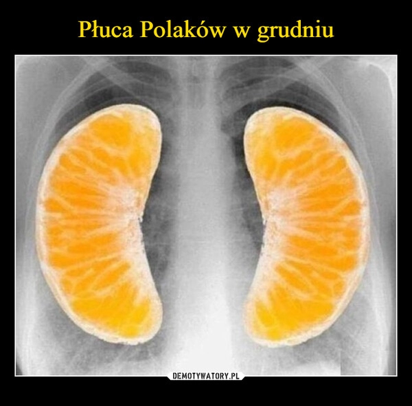 
    Płuca Polaków w grudniu