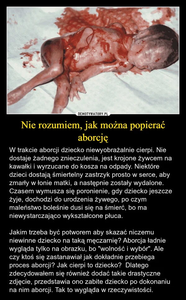 
    Nie rozumiem, jak można popierać aborcję
