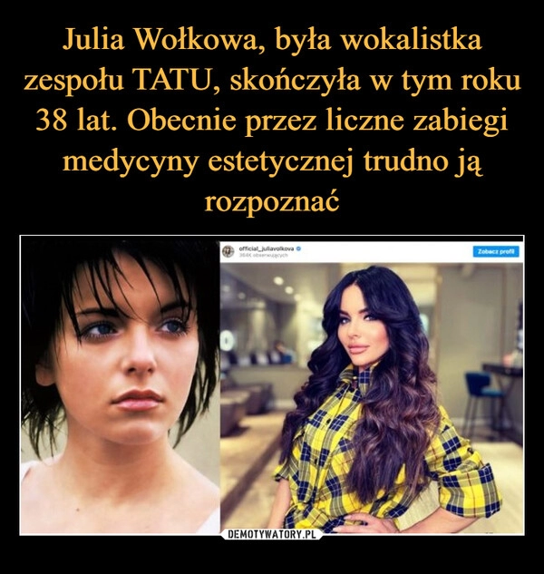 
    Julia Wołkowa, była wokalistka zespołu TATU, skończyła w tym roku 38 lat. Obecnie przez liczne zabiegi medycyny estetycznej trudno ją rozpoznać