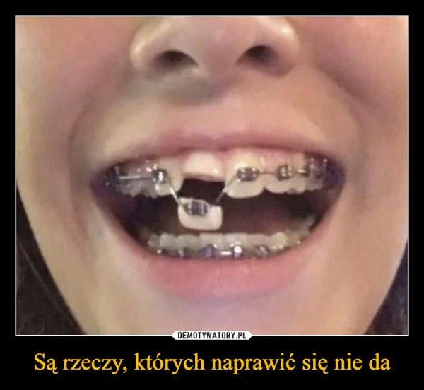 
    Są rzeczy, których naprawić się nie da