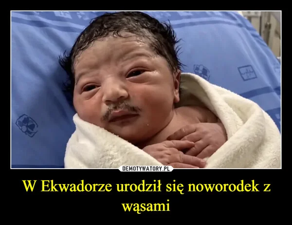 
    W Ekwadorze urodził się noworodek z wąsami
