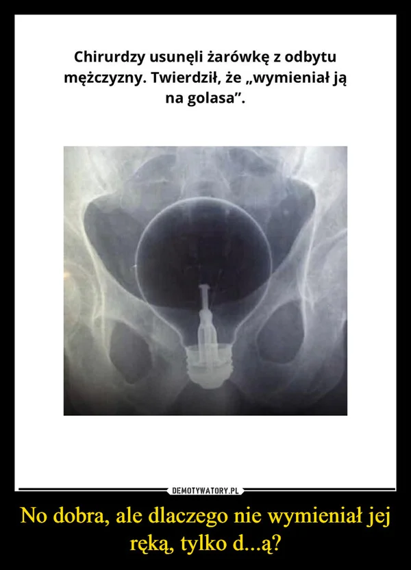 
    No dobra, ale dlaczego nie wymieniał jej ręką, tylko d...ą?