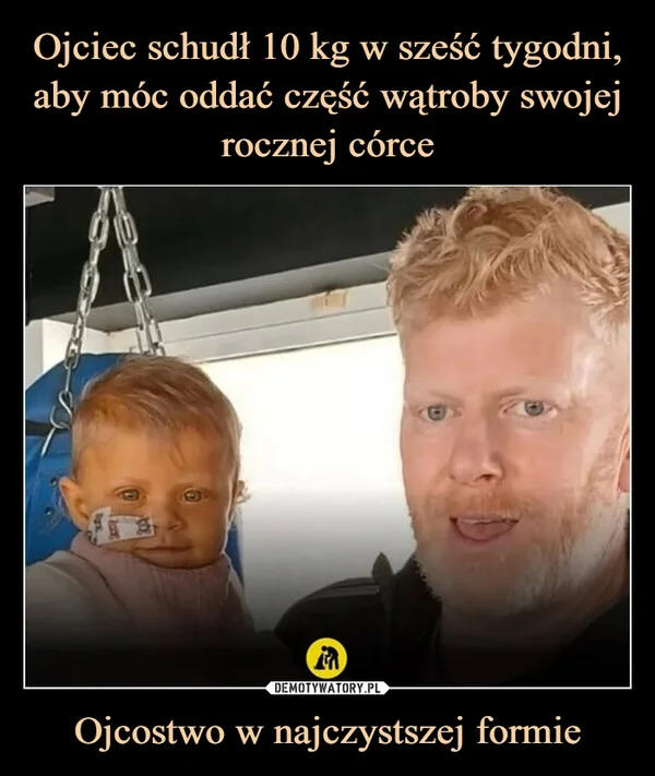 
    Ojciec schudł 10 kg w sześć tygodni, aby móc oddać część wątroby swojej rocznej córce Ojcostwo w najczystszej formie