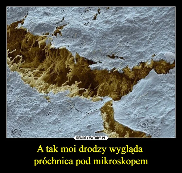 
    A tak moi drodzy wygląda próchnica pod mikroskopem