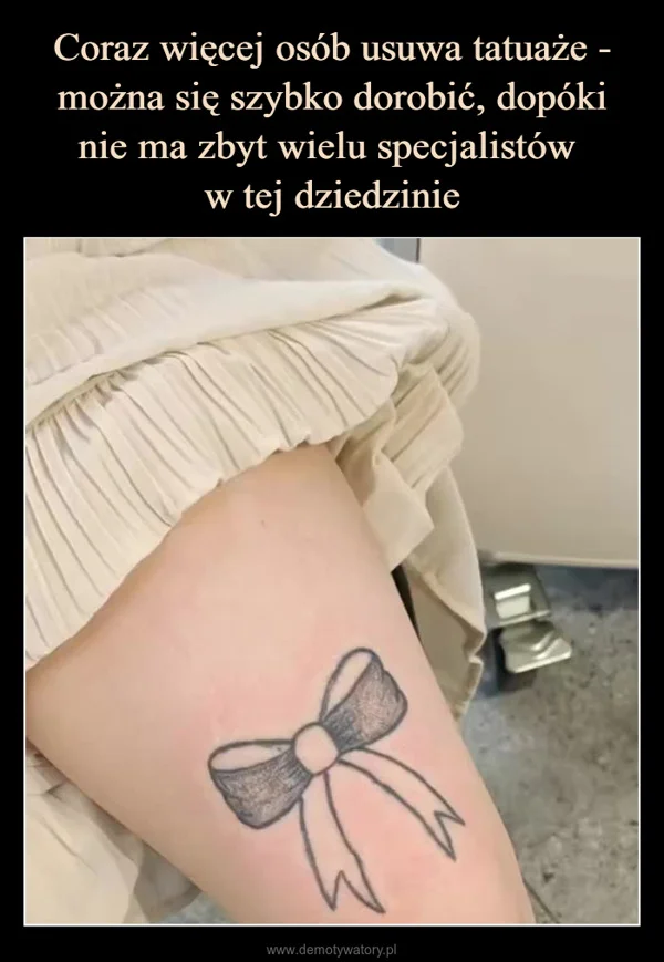 
    Coraz więcej osób usuwa tatuaże - można się szybko dorobić, dopóki nie ma zbyt wielu specjalistów w tej dziedzinie