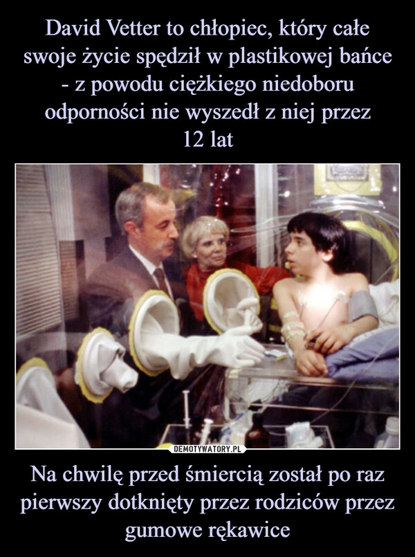 
    David Vetter to chłopiec, który całe swoje życie spędził w plastikowej bańce - z powodu ciężkiego niedoboru odporności nie wyszedł z niej przez
12 lat Na chwilę przed śmiercią został po raz pierwszy dotknięty przez rodziców przez gumowe rękawice