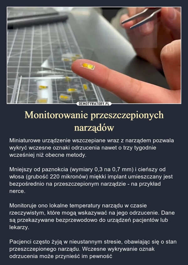 
    Monitorowanie przeszczepionych narządów