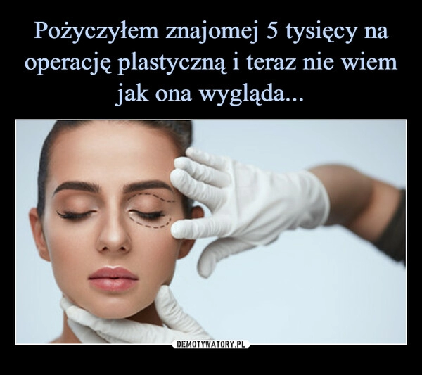 
    Pożyczyłem znajomej 5 tysięcy na operację plastyczną i teraz nie wiem jak ona wygląda...