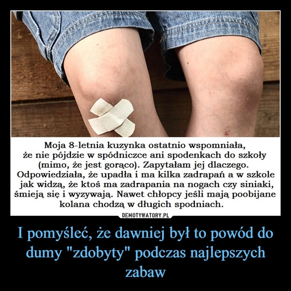 
    I pomyśleć, że dawniej był to powód do dumy "zdobyty" podczas najlepszych zabaw