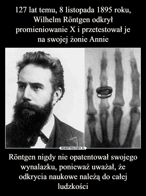 
    
127 lat temu, 8 listopada 1895 roku, Wilhelm Röntgen odkrył promieniowanie X i przetestował je
na swojej żonie Annie Röntgen nigdy nie opatentował swojego wynalazku, ponieważ uważał, że odkrycia naukowe należą do całej ludzkości 