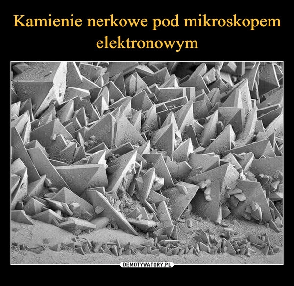 
    Kamienie nerkowe pod mikroskopem elektronowym