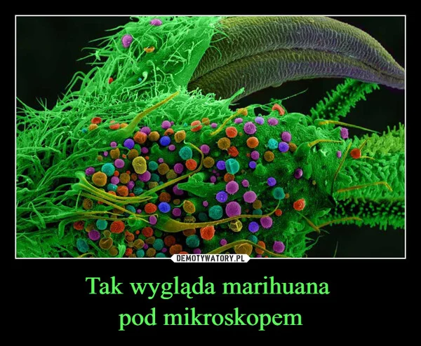 
    Tak wygląda marihuana pod mikroskopem