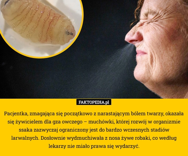 
    Pacjentka, zmagająca się początkowo z narastającym bólem twarzy, okazała