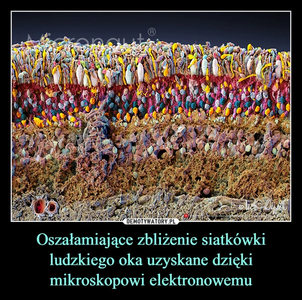 
    Oszałamiające zbliżenie siatkówki ludzkiego oka uzyskane dzięki mikroskopowi elektronowemu