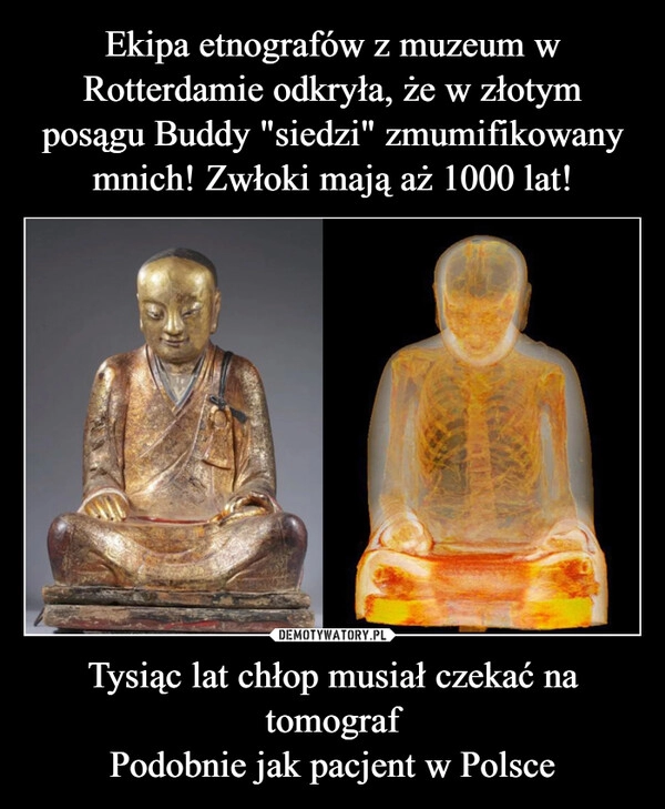 
    Ekipa etnografów z muzeum w Rotterdamie odkryła, że w złotym posągu Buddy "siedzi" zmumifikowany mnich! Zwłoki mają aż 1000 lat! Tysiąc lat chłop musiał czekać na tomograf
Podobnie jak pacjent w Polsce