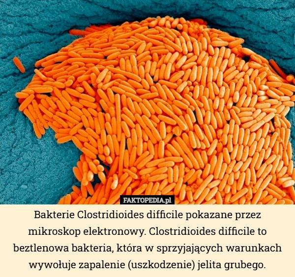 
    Bakterie Clostridioides difficile pokazane przez mikroskop elektronowy...