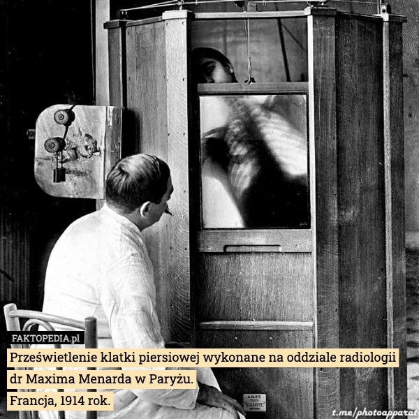 
    Prześwietlenie klatki piersiowej wykonane na oddziale radiologii dr Maxima