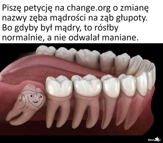 
    Ząb mądrości 