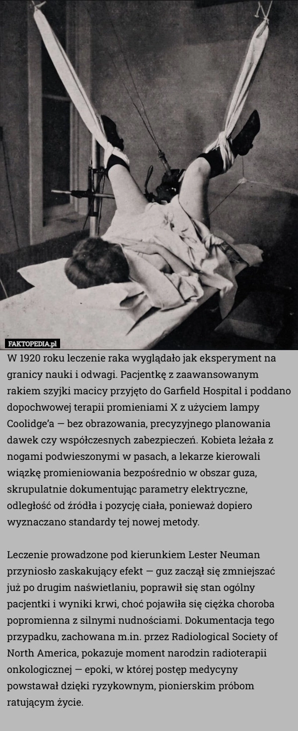 
    W 1920 roku leczenie raka wyglądało jak eksperyment na granicy nauki i odwagi.