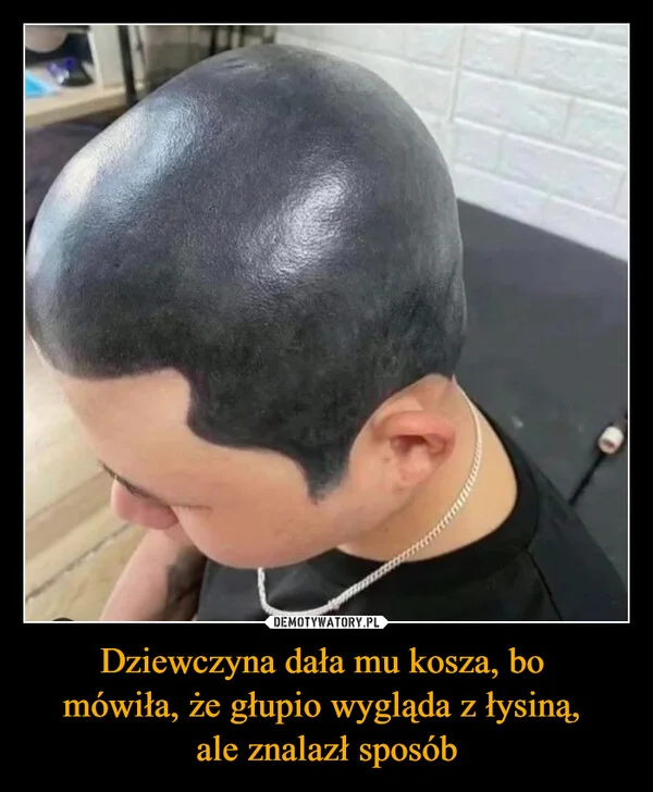 
    Dziewczyna dała mu kosza, bo mówiła, że głupio wygląda z łysiną, ale znalazł sposób