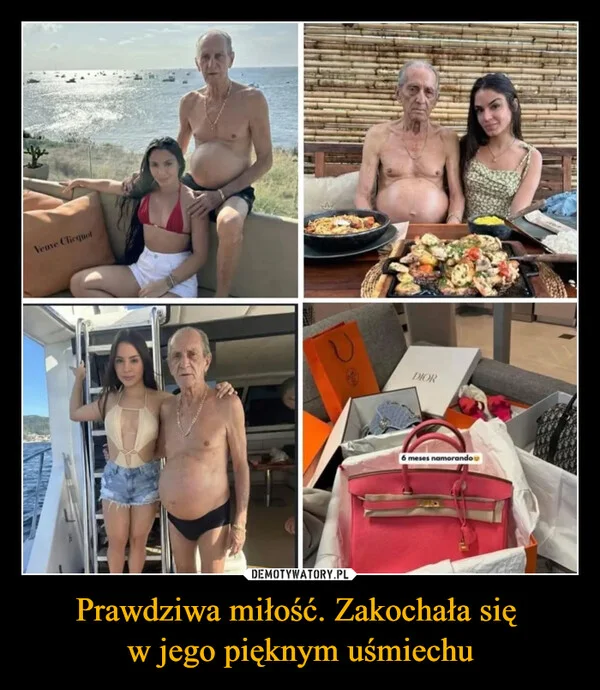 
    Prawdziwa miłość. Zakochała się w jego pięknym uśmiechu