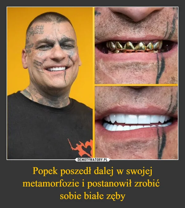 
    Popek poszedł dalej w swojej metamorfozie i postanowił zrobić sobie białe zęby